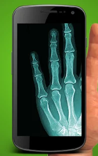  X射線掃描儀 - 螢幕擷取畫面縮圖  