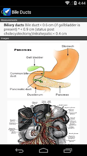 How to download Ultrasound by iSonographer lastet apk for laptop
