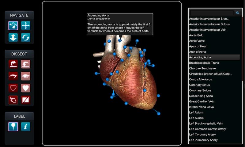 VirtualHeart3D Screen 3