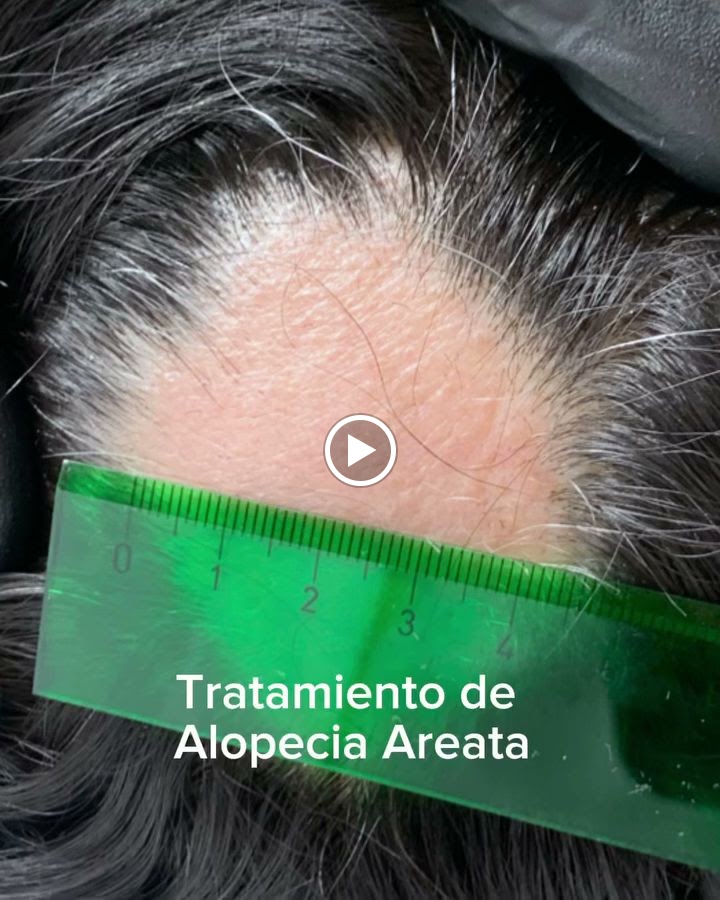 Instituto Geneve Medicina y Estetica — Videos