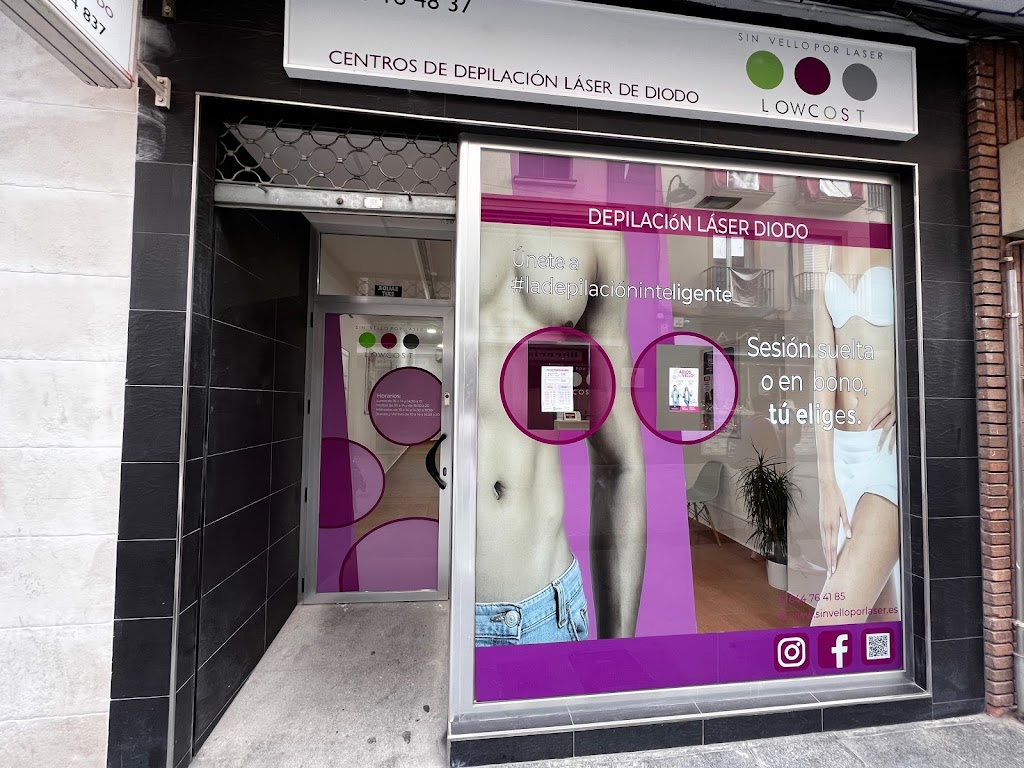 SinVello! Andujar | Depilacion Laser Diodo