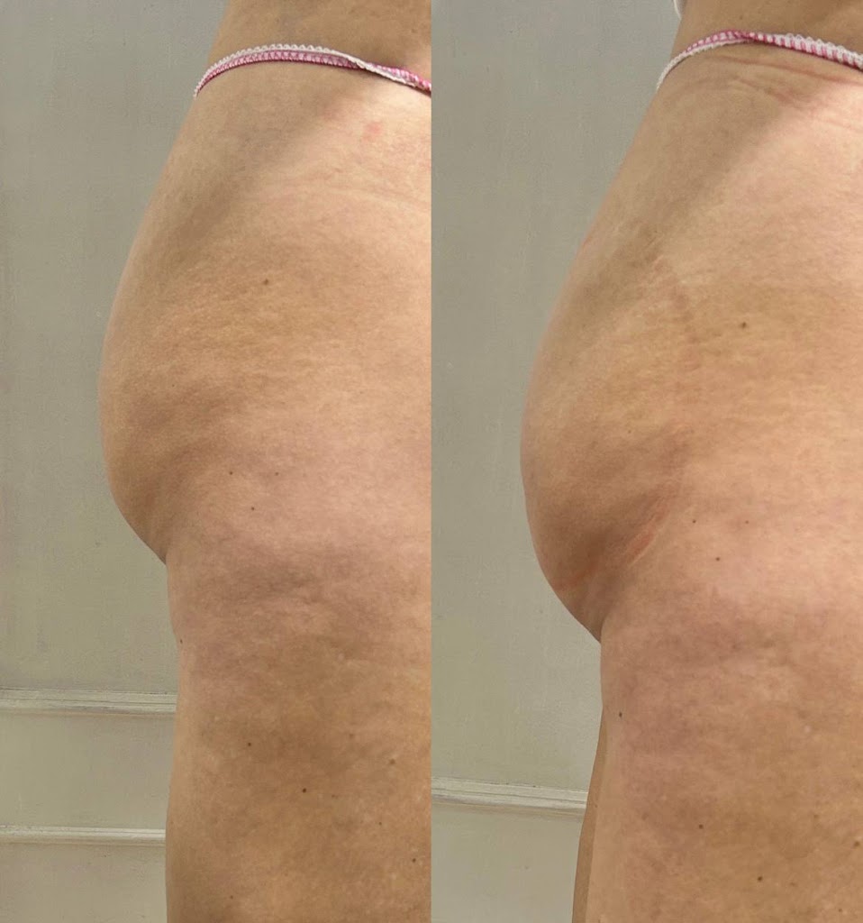 AnyLopez Clinica Estetica — Mas recientes