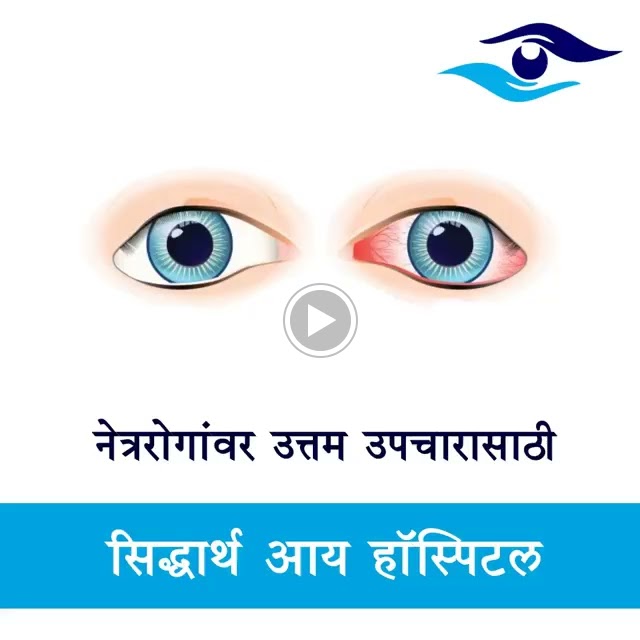Dr Sidharth Eye Hospital Dr Sidharth Vivek Patane Mbbs Doms Dnb Fgo