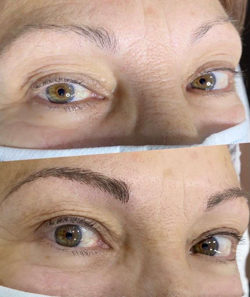 LASER DIODO Alta Estetica Ana Rich