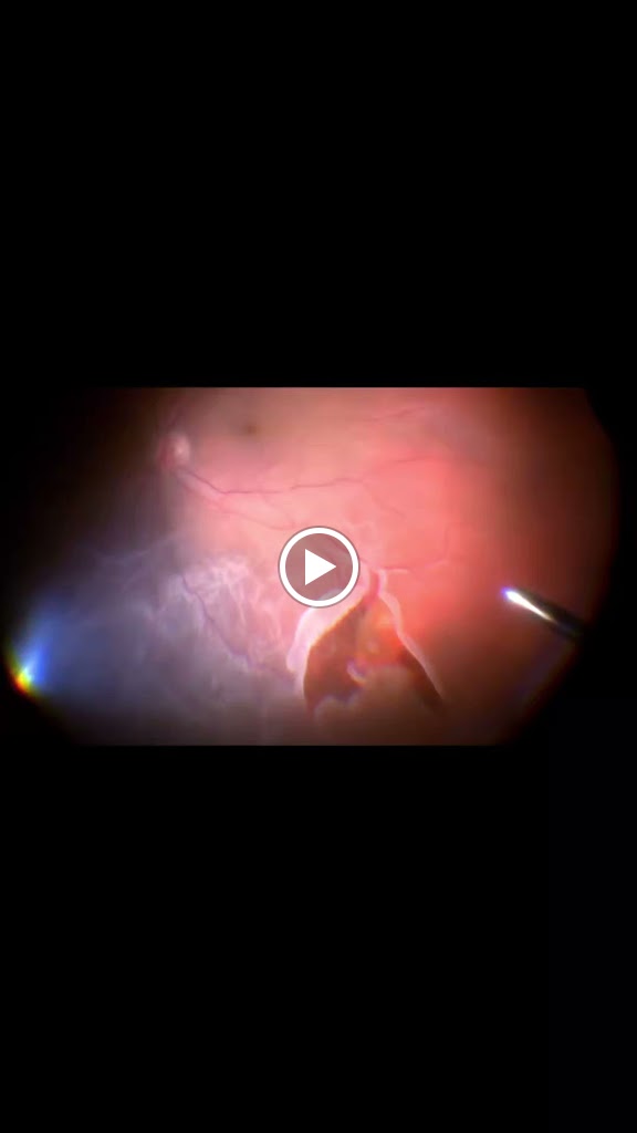 Videos