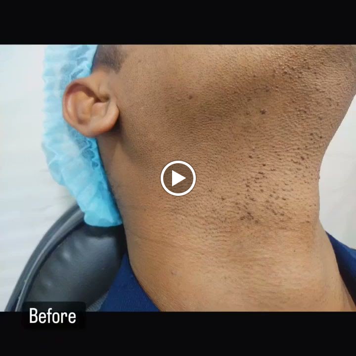 Srihan Institute Of Dental Lasers Cosmetology