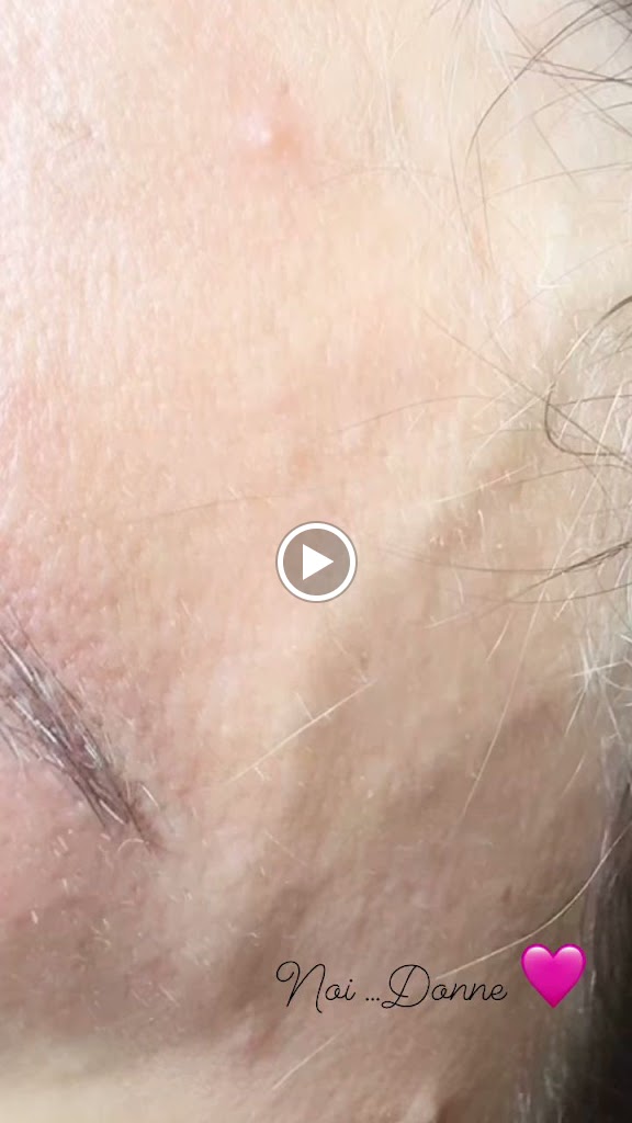 Carla Ferrara | Medicina estetica | Master Micropigmentacion, Microblading y Tratamiento cara en Costa Adeje, Tenerife Sur — Videos