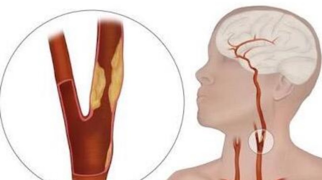 Dr. Vascular Surgeon In Nellore Dr Narendranadh Meda