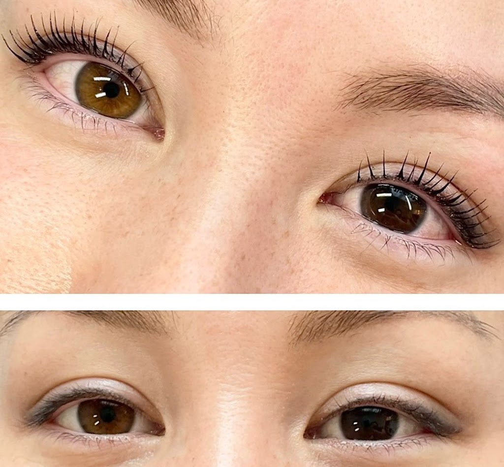 Dry Eye Clinic By The Eye Doctor