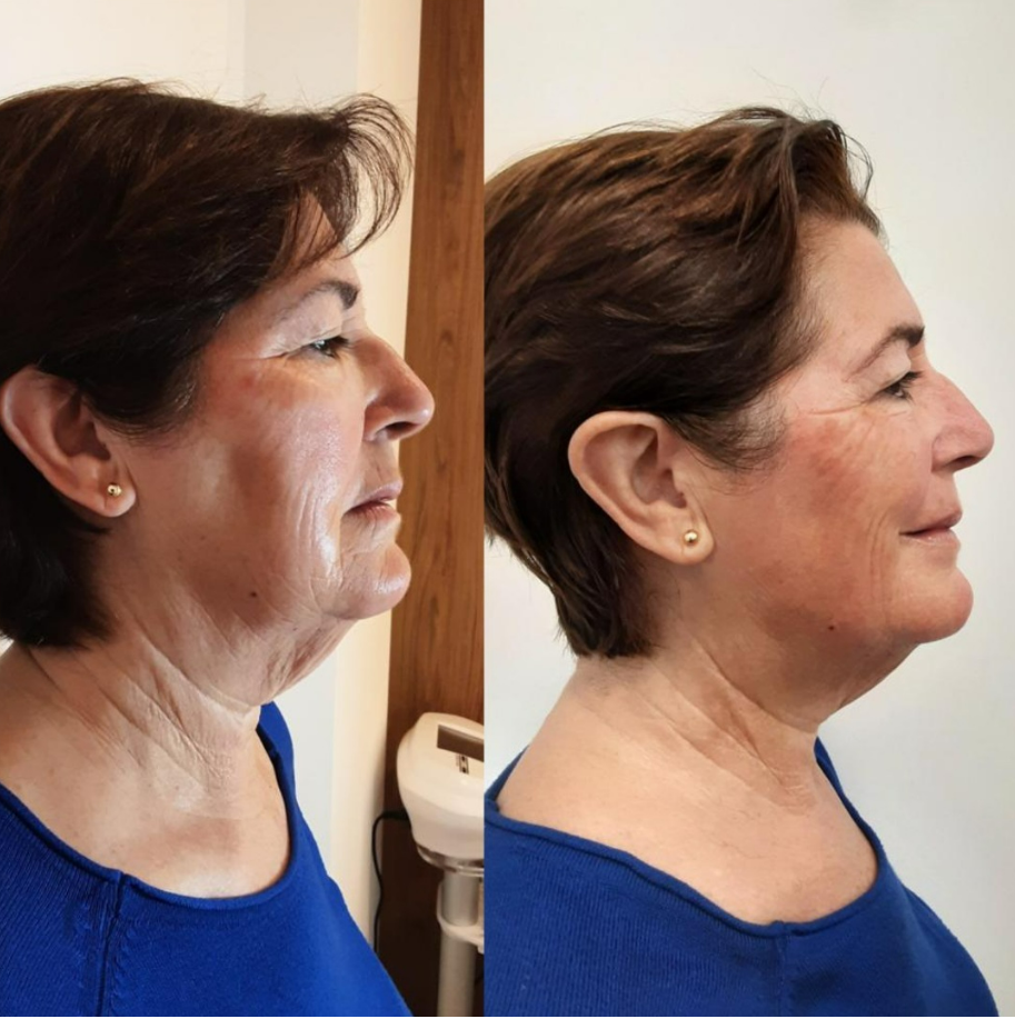 BELA BEAUTY CENTER - CLINICA ESTETICA & PELUQUERIA — Del propietario