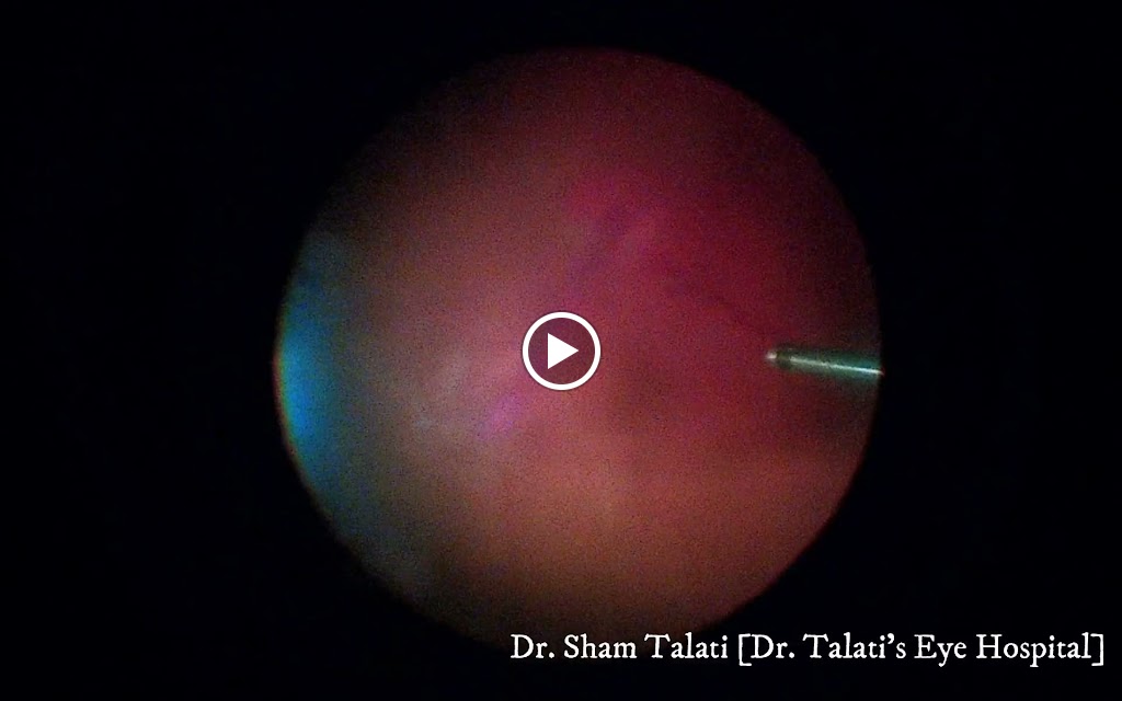 Videos