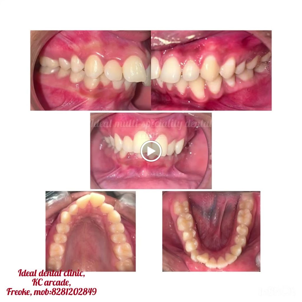 IDEAL DENTAL CLINIC & ORTHODONTIC CENTER