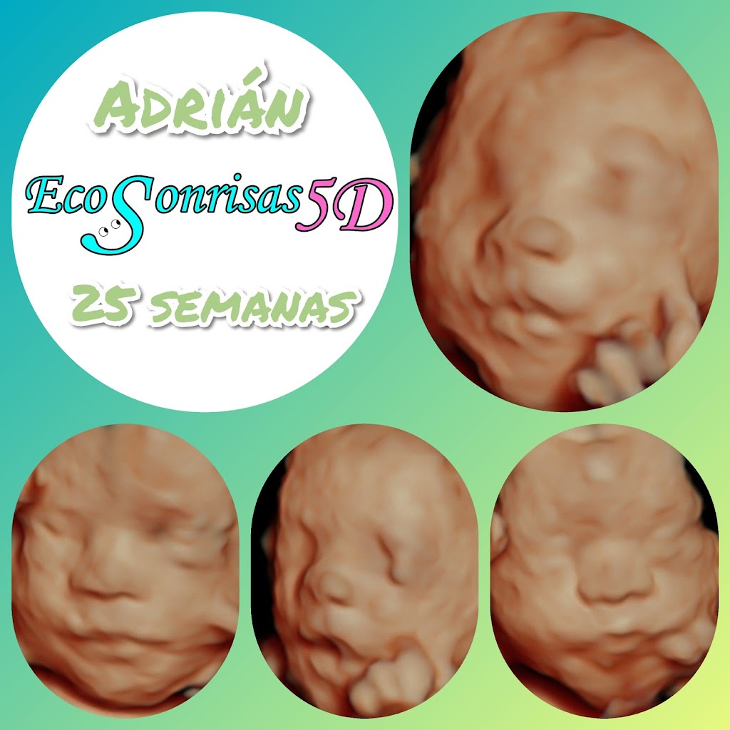 Ecosonrisas 5D Illescas - Especialistas en ecografia 5D y 4D