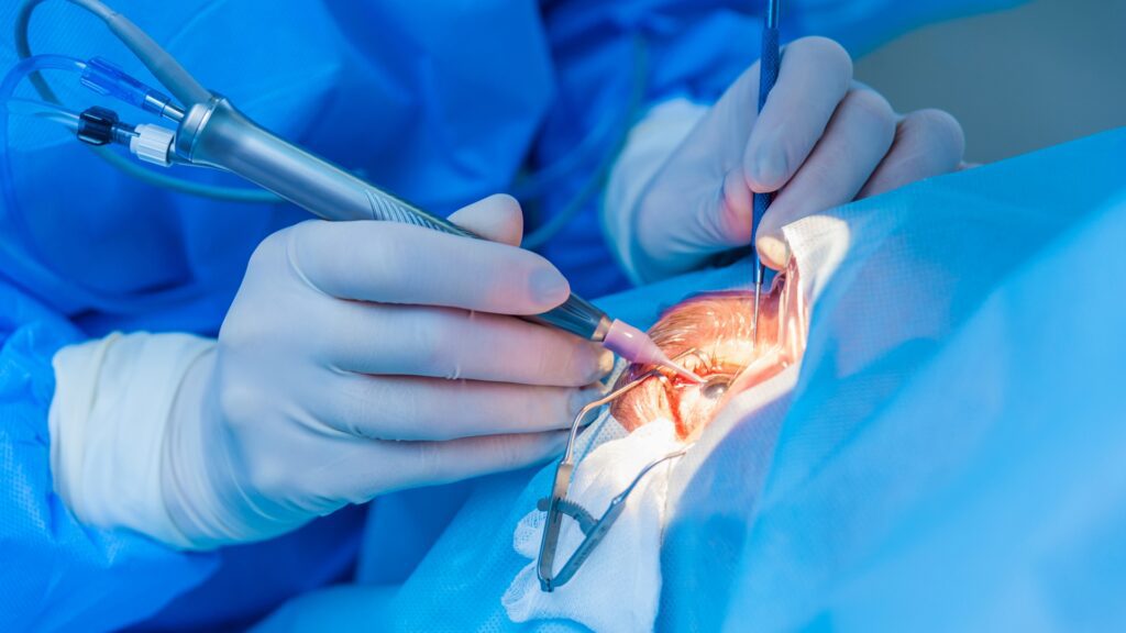 Mohali Eye Consultants