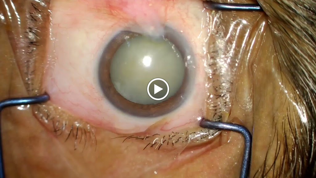 Dr Pavan Eye Laser Hospital