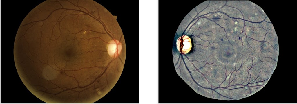 Cuidamos tu vista en Novelda