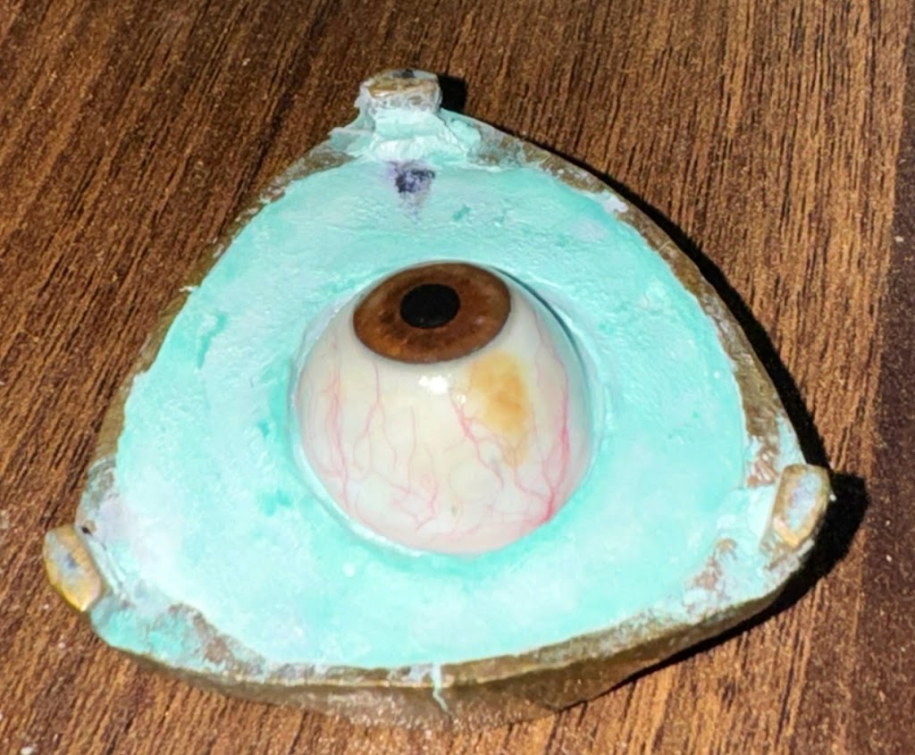 Care Touch Vision Centre Best Artificial Eye Centre In Lucknow