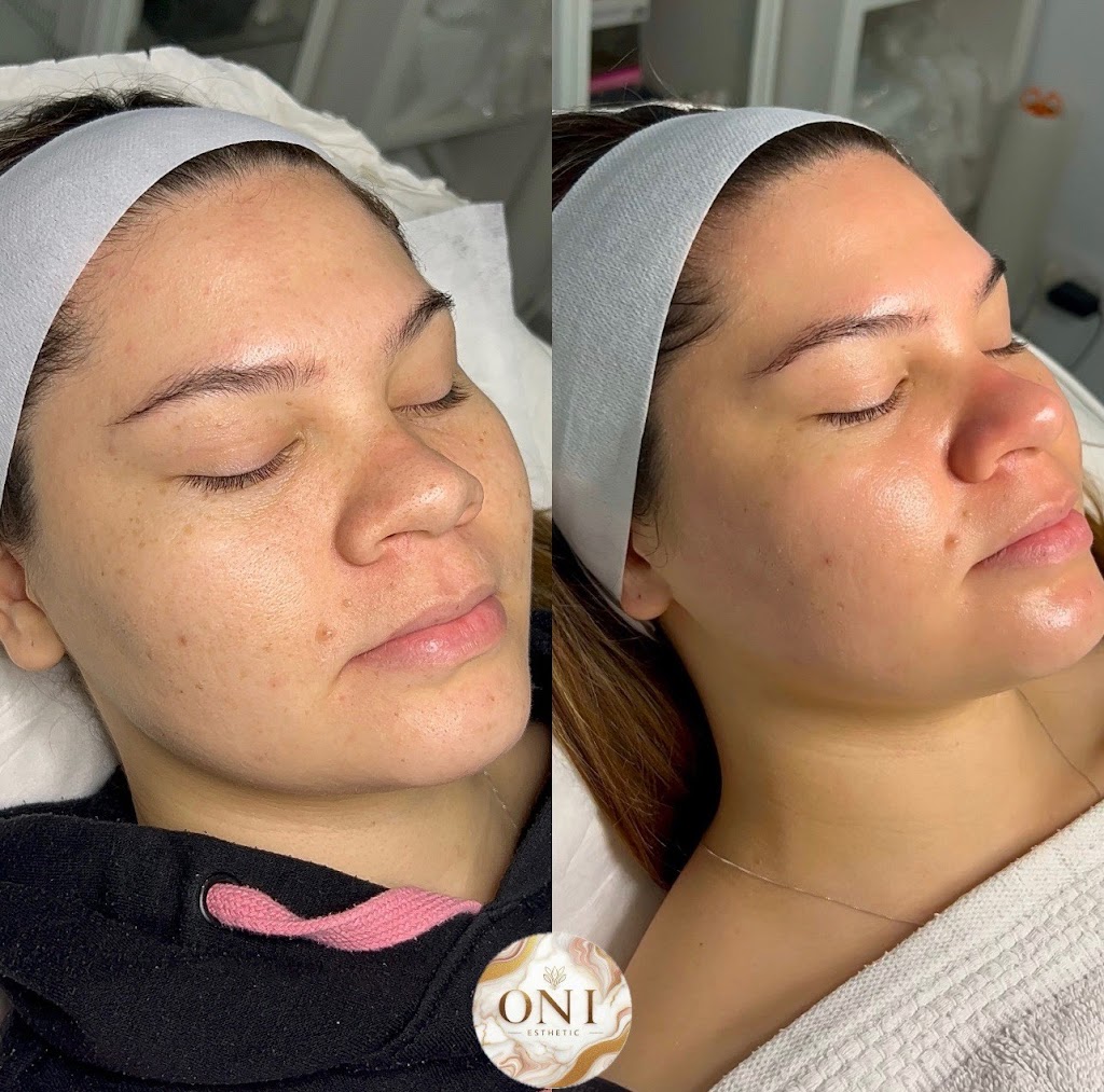 Centro de Depilacion y Estetica Oni Esthetic No+vello