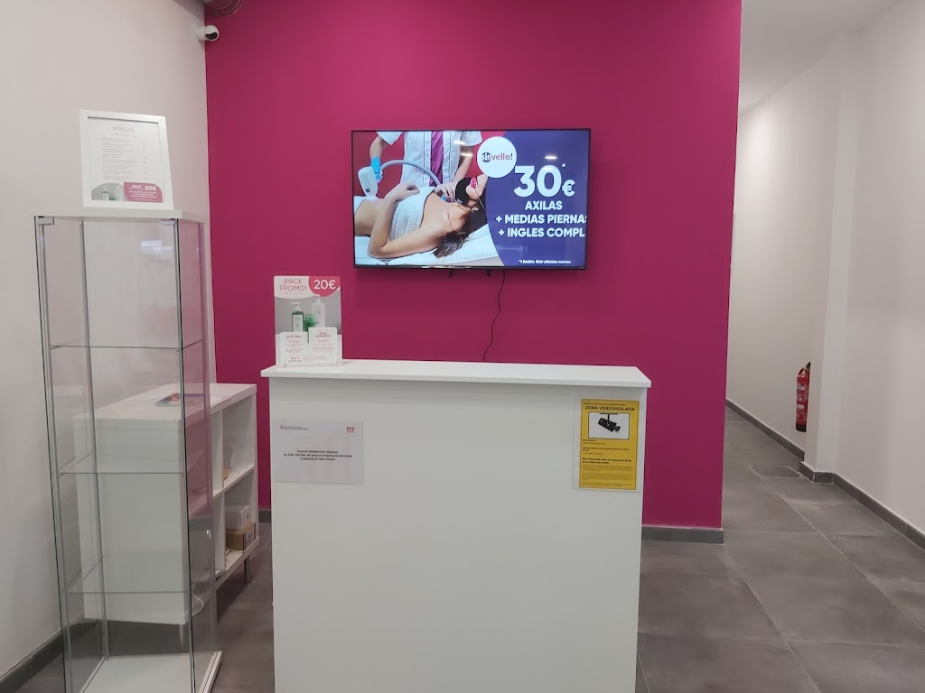 SinVello! Mataro | Depilacion Laser Diodo