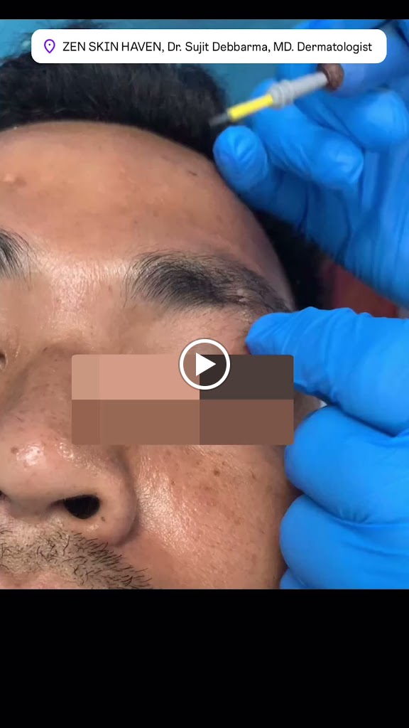 Zen Skin Haven Dr Sujit Debbarma Md Dermatologist Skin Hair Laser Clinic