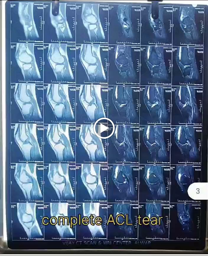 Videos