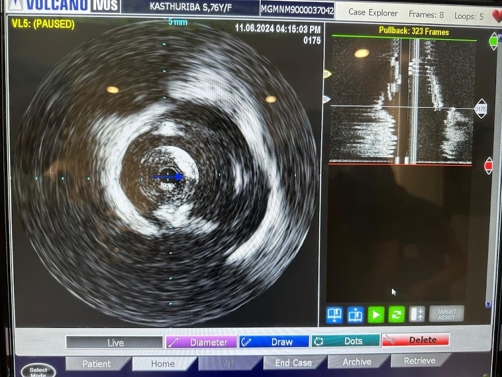 Dr. Dr Kuldeep R Totawar Best Cardiologist In Aurangabad Heart Specialist In Aurangabad 2D Echo Angiography Angioplasty