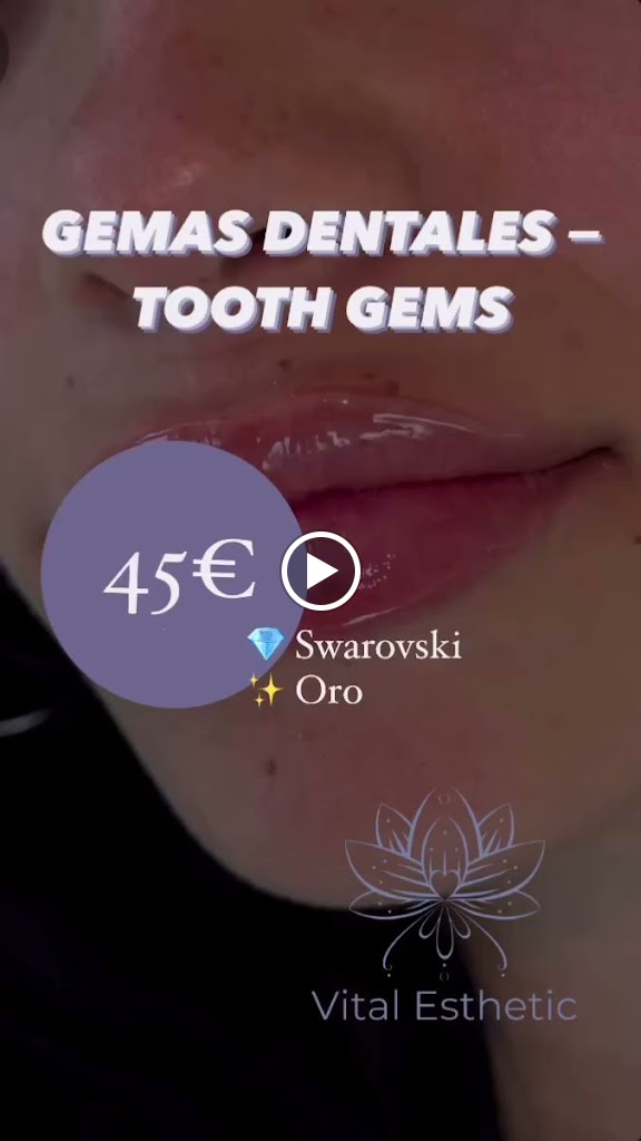 Vital Esthetic / Centro de estetica en Palma de Mallorca, HIFU, INDIBA — Videos