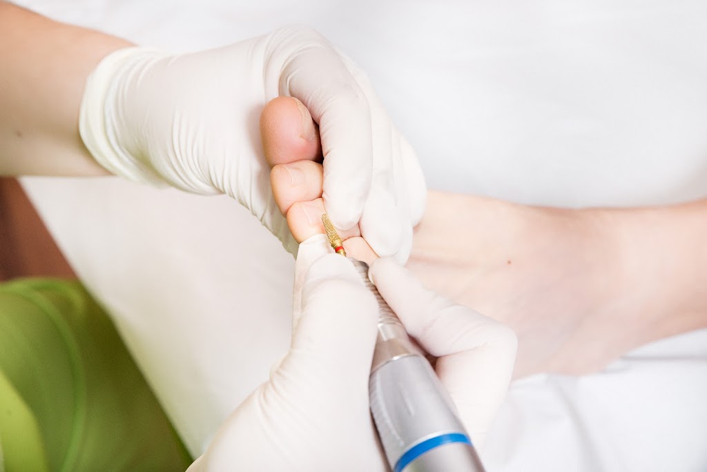 Clinica Podologica Mireia Serrano. Atendemos pie diabetico seguridad social. Podologo El Masnou