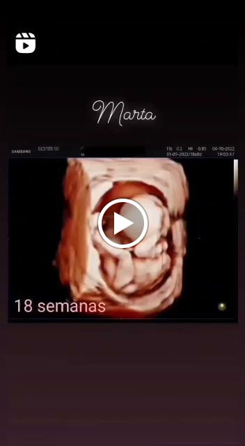 Gestos 5D - Centro de Ecografia 5D en Sevilla — Videos