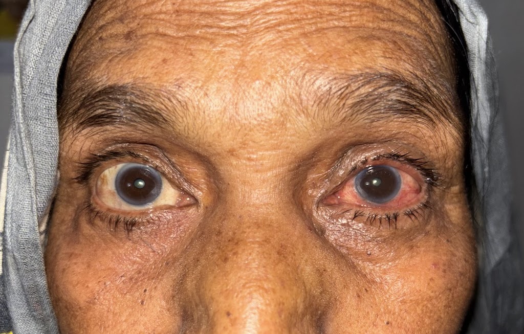Apex Vision Care