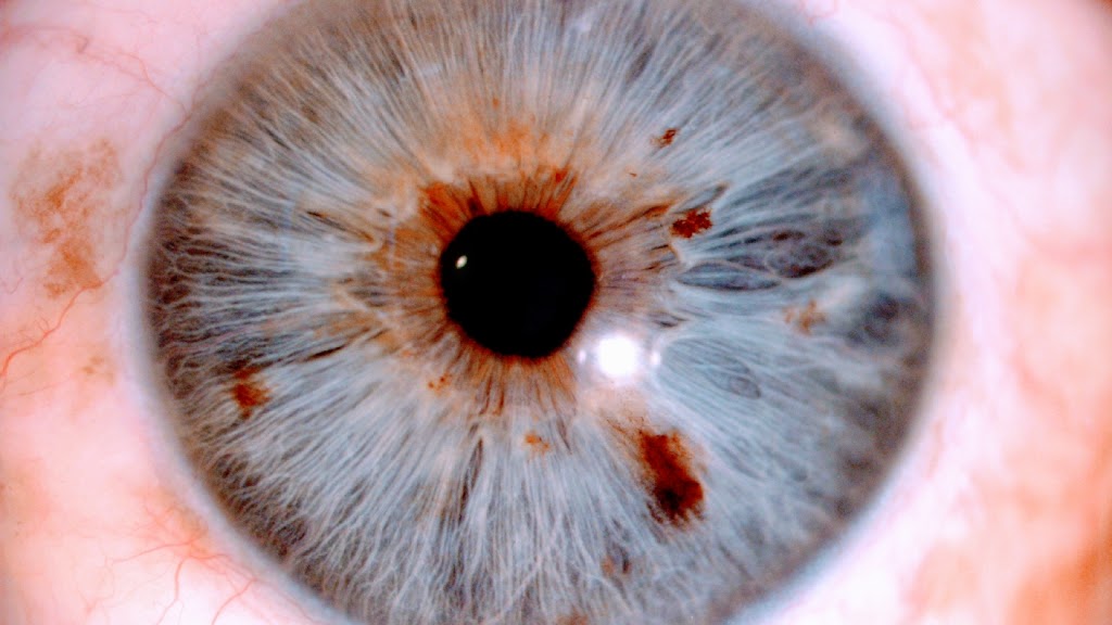 Cornea Eye Hospital Best Eye Hospital Cornea Transplant Keratoconus