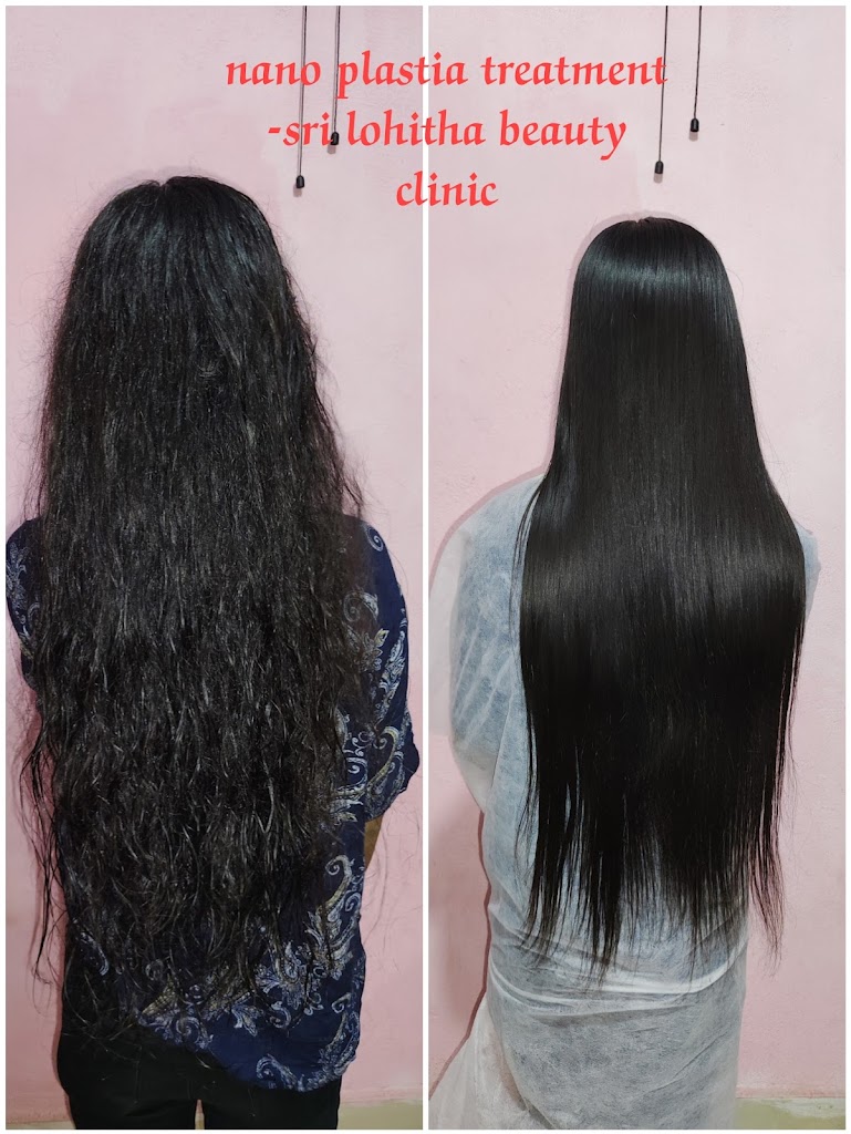 Sri Lohitha Beauty Clinic