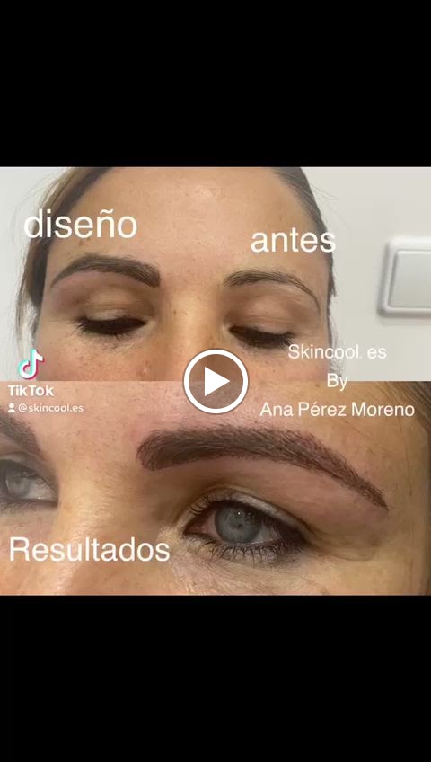 SKIN COOL — Videos