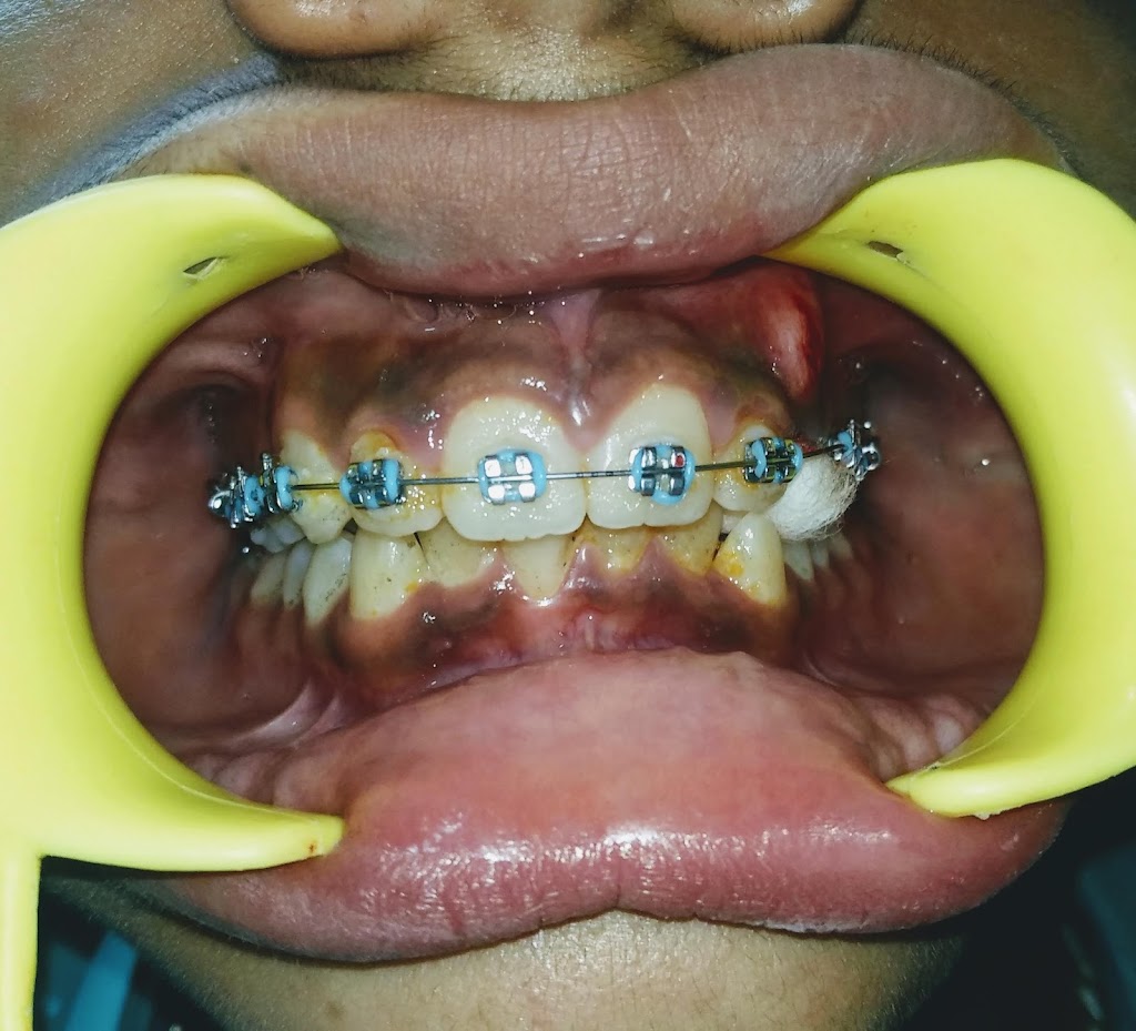 Dr. Pearls Dental Clinic Implant Center