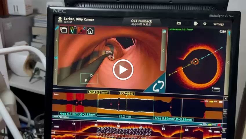 Dr. Dr Debdatta Majumdar Best Interventional Cardiologist In Rn Tagore Kolkata Cardiologist Pacemaker Implantation Doctor