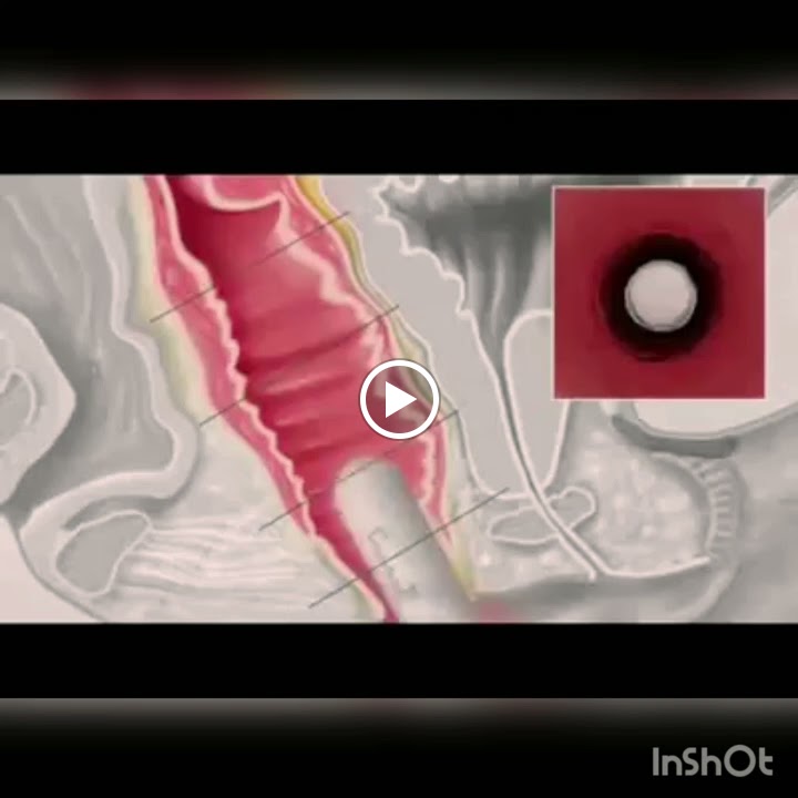 Ima Estetica i Salut — Videos
