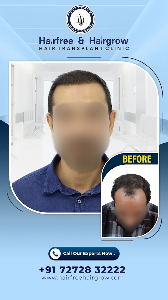 Hairfree & Hairgrow Hair Loss & Hair Transplant Clinic