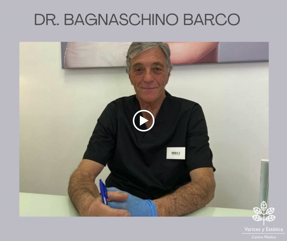 VARICES Y ESTETICA/ Medicina estetica