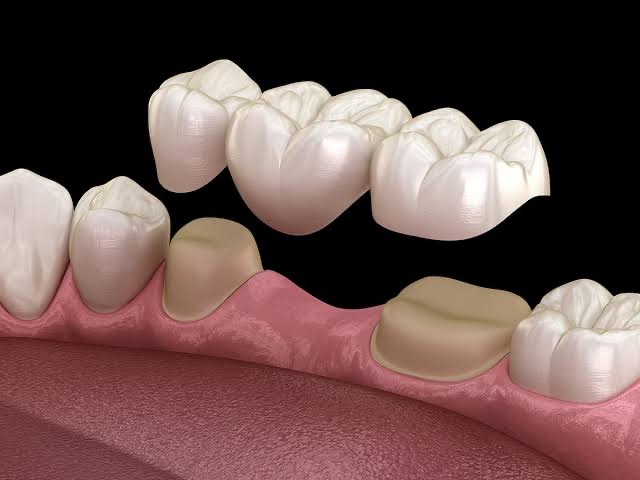 BHARGAV SUPER SPECALITY DENTAL HOSPITAL