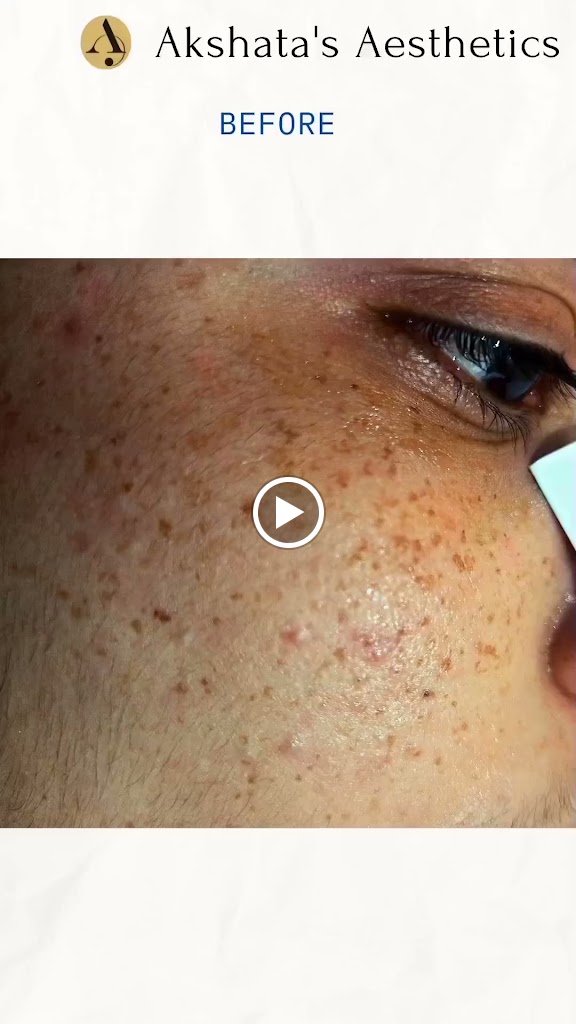 Akshata S Aesthetics For Skin Hair