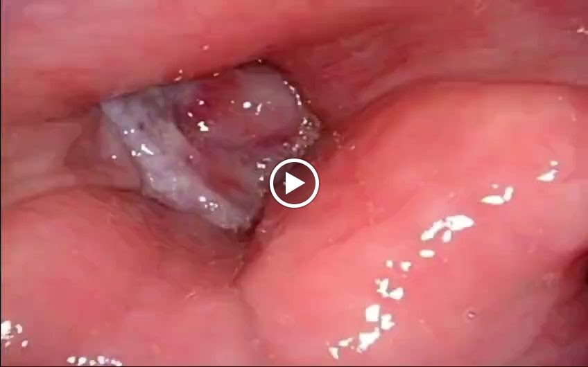 Videos
