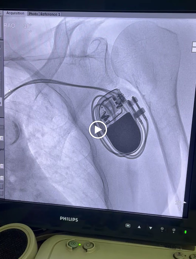 Dr. Dr Chetan Rathi Best Cardiologist In Nagpur Best Heart Specialist In Nagpur