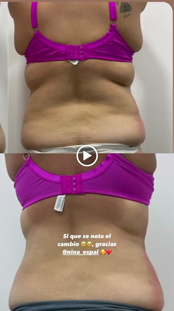 Nina Espai Estetica — Videos