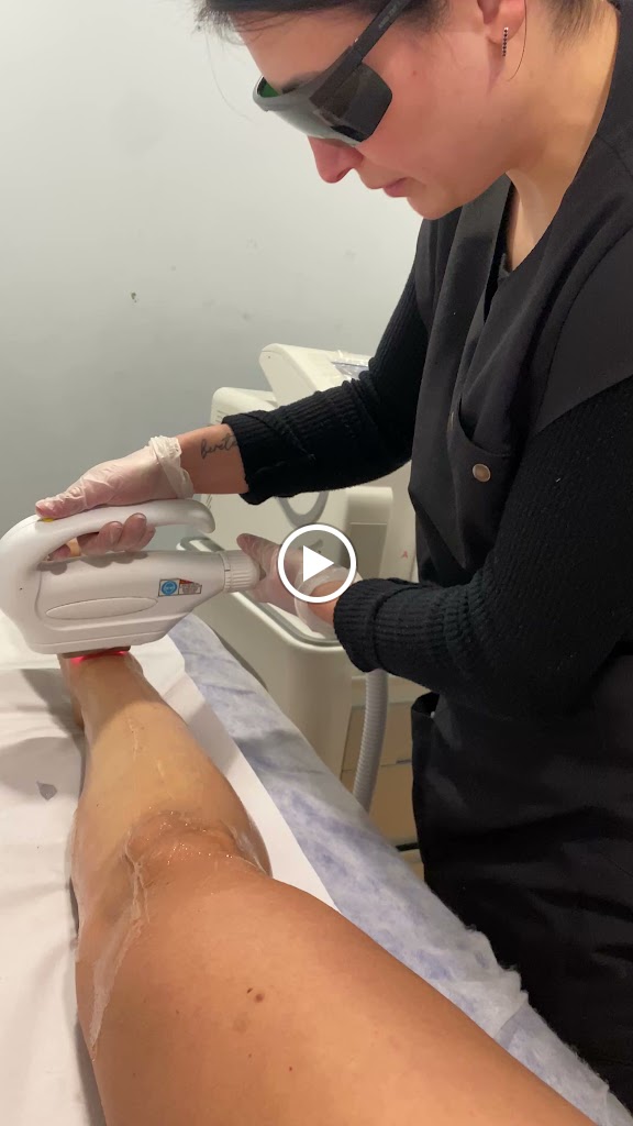 Nueva Belleza - Indiba, Laser y Tratamientos — Del propietario