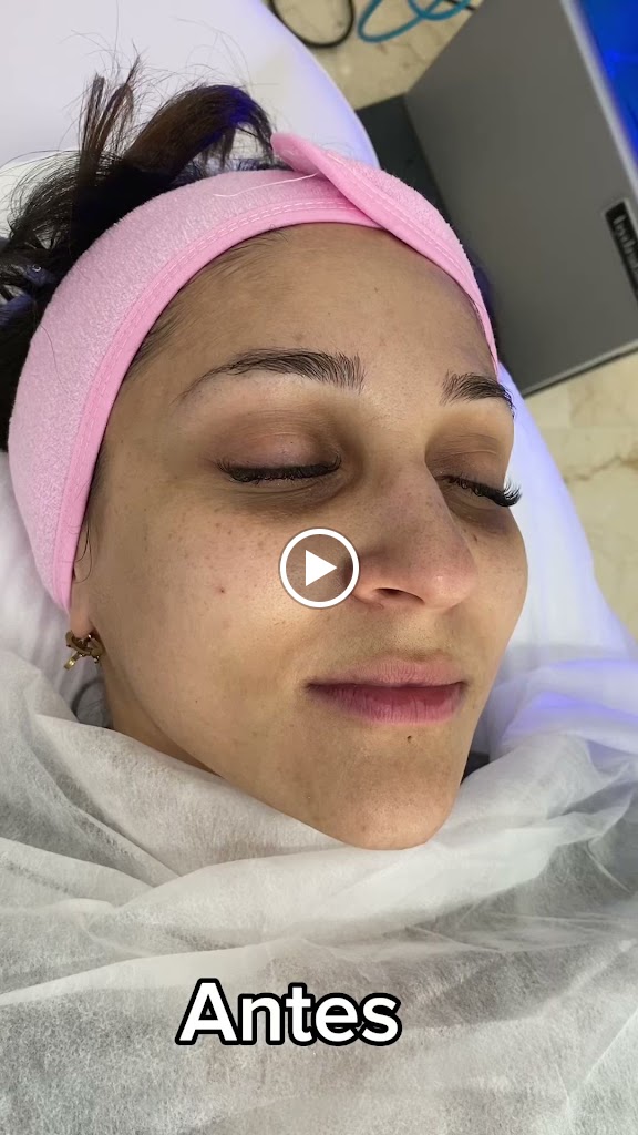 EBA Beauty Marbella by Elena Badini — Videos