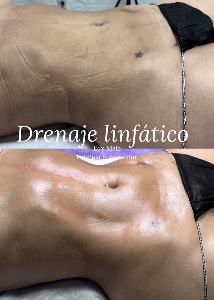 Edy Melo Estetica & Bienestar