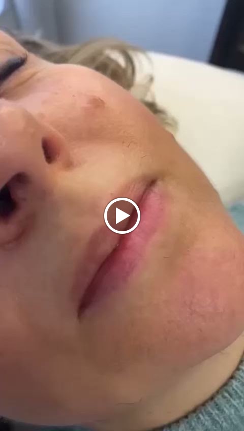 Bio-estetica Nuria Salas — Videos