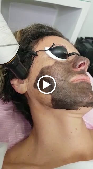 Centro de Estetica Teresa Navarro — Videos