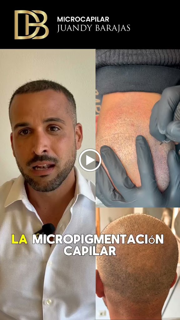 Microblading Las Palmas - Micropigmentacion Las Palmas - Diana Barajas Clinica Estetica — Del propietario