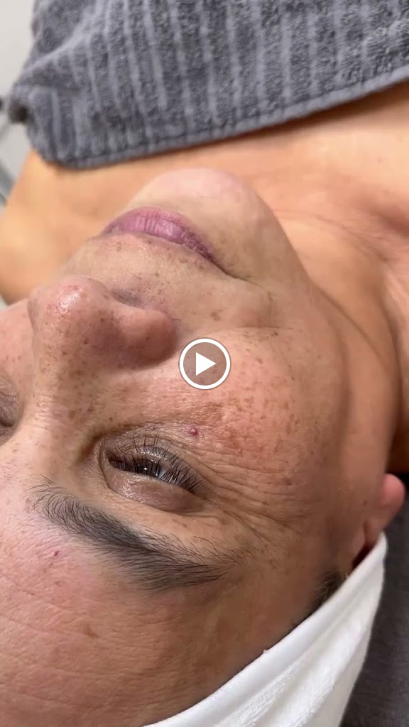 Rejuvelook - Clinica Estetica Fuengirola, Malaga — Del propietario